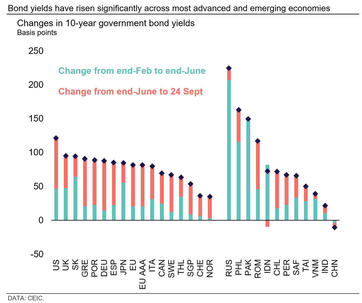 Bond